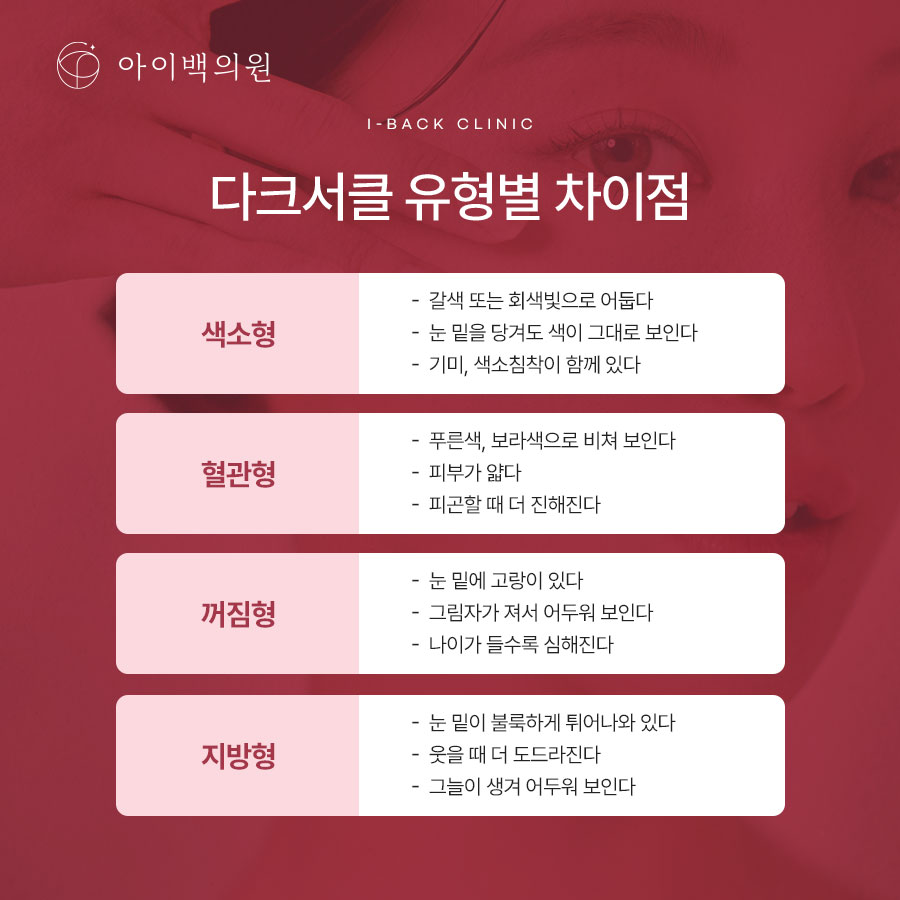 강남 아이백의원 눈밑다크서클,원인에 따라 치료 방법이 달라질 수 있습니다