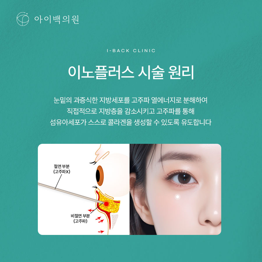 강남 눈밑지 잘하는곳? 비절개 눈밑지방재배치, 어디로 가야할까
