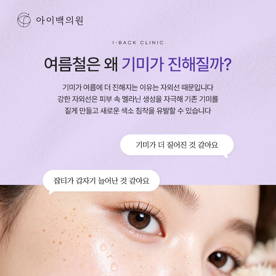 역삼동 아이백의원 기미치료, 여름철 기미 고민이라면 아이콘 맥스지를 알아보세요