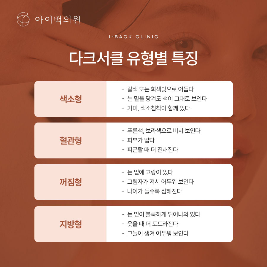 신논현역 아이백의원 다크서클, 유형별 치료 방법 알아보기