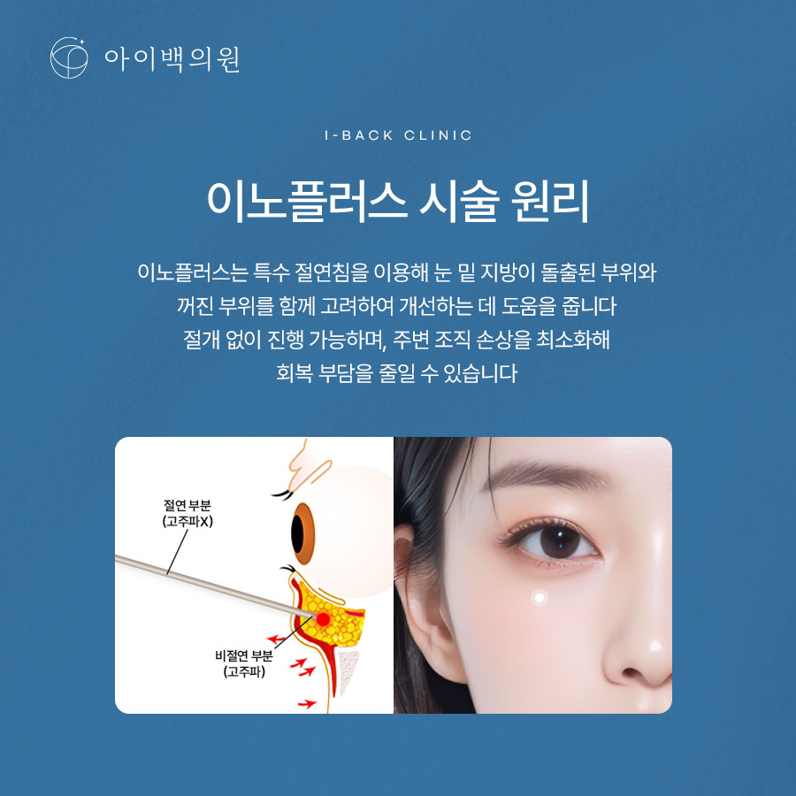 강남 아이백의원 눈밑꺼짐, 단순히 볼륨 부족만의 문제일까요?
