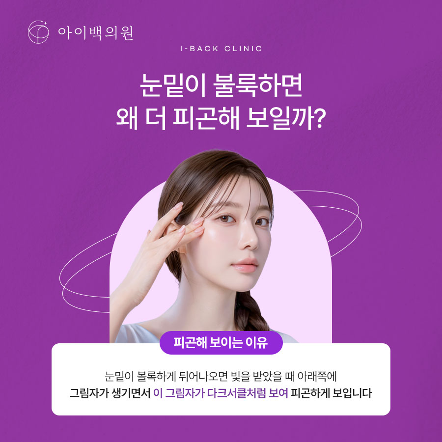 신논현 아이백의원 눈밑지방재배치,돌출되고 처지는 눈밑 변화가 시작됐다면