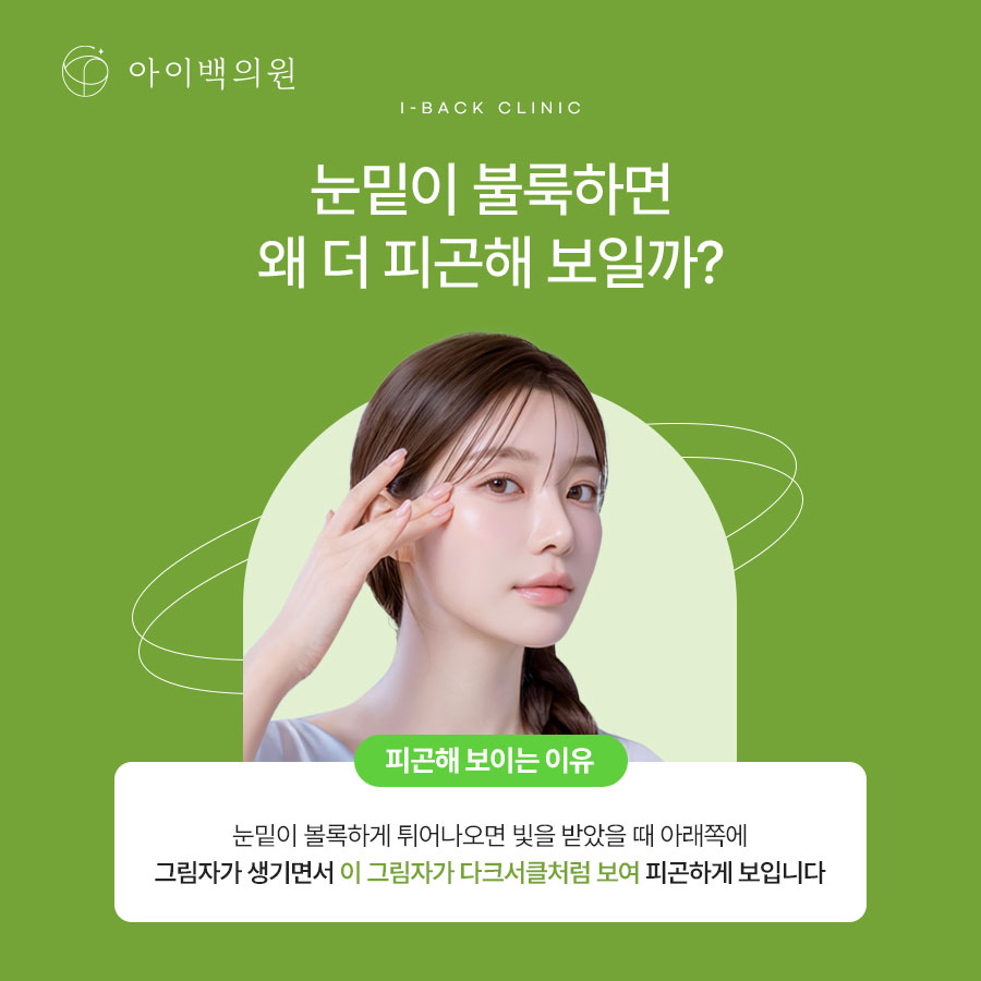 역삼 비절개 눈밑지방재배치,깨끗한 인상을 위한 눈 밑 관리